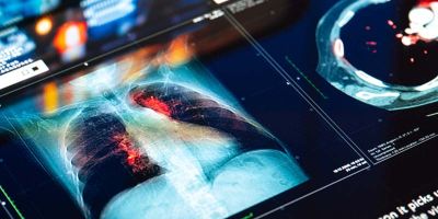 MRI diagnostic imaging results